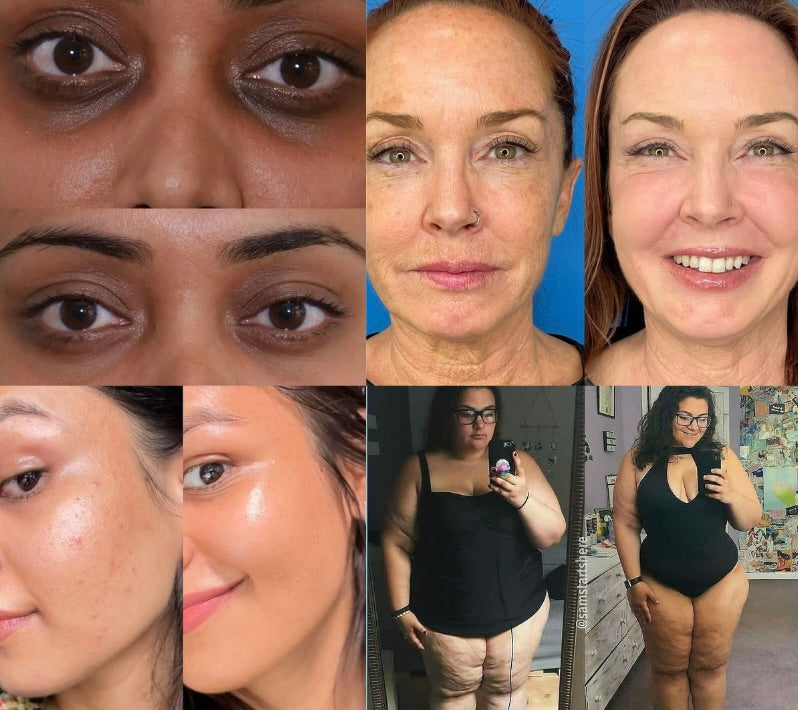 Astaxanthin | Antioxidant Softgels (12 mg)