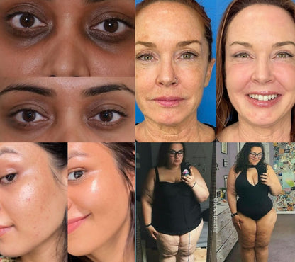 Astaxanthin | Antioxidant Softgels (12 mg)