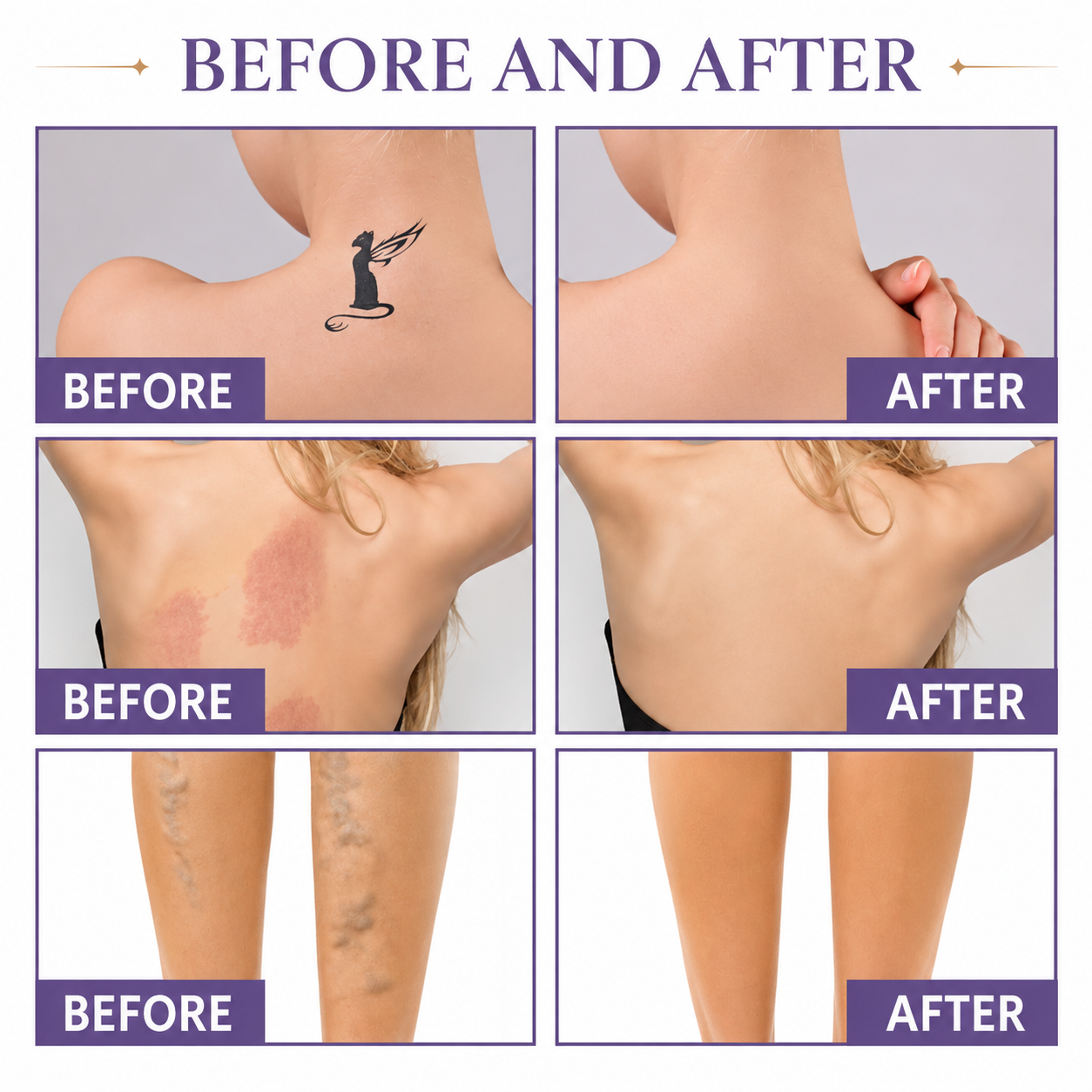 TRIVEA™ Body Concealer