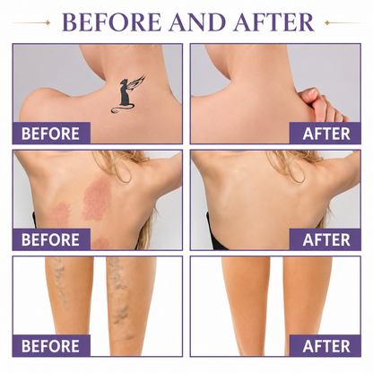 TRIVEA™ Body Concealer